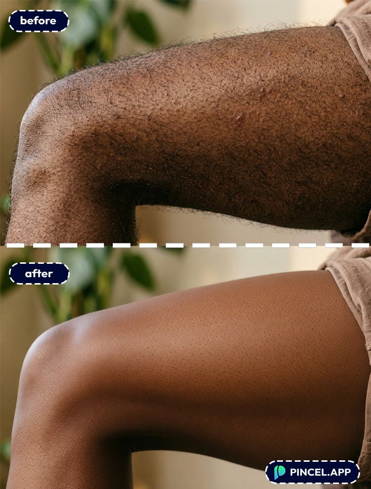 01_before-after-removing-leg-hair-with-pincel-AI-man-leg