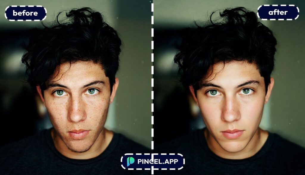 before-after-clearing-skin-texture-with-pincel-AI-teenage-boy-with-facial-spots