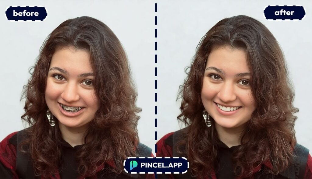 01_before-after-removing-dental-braces-with-pincel-AI-young-girl
