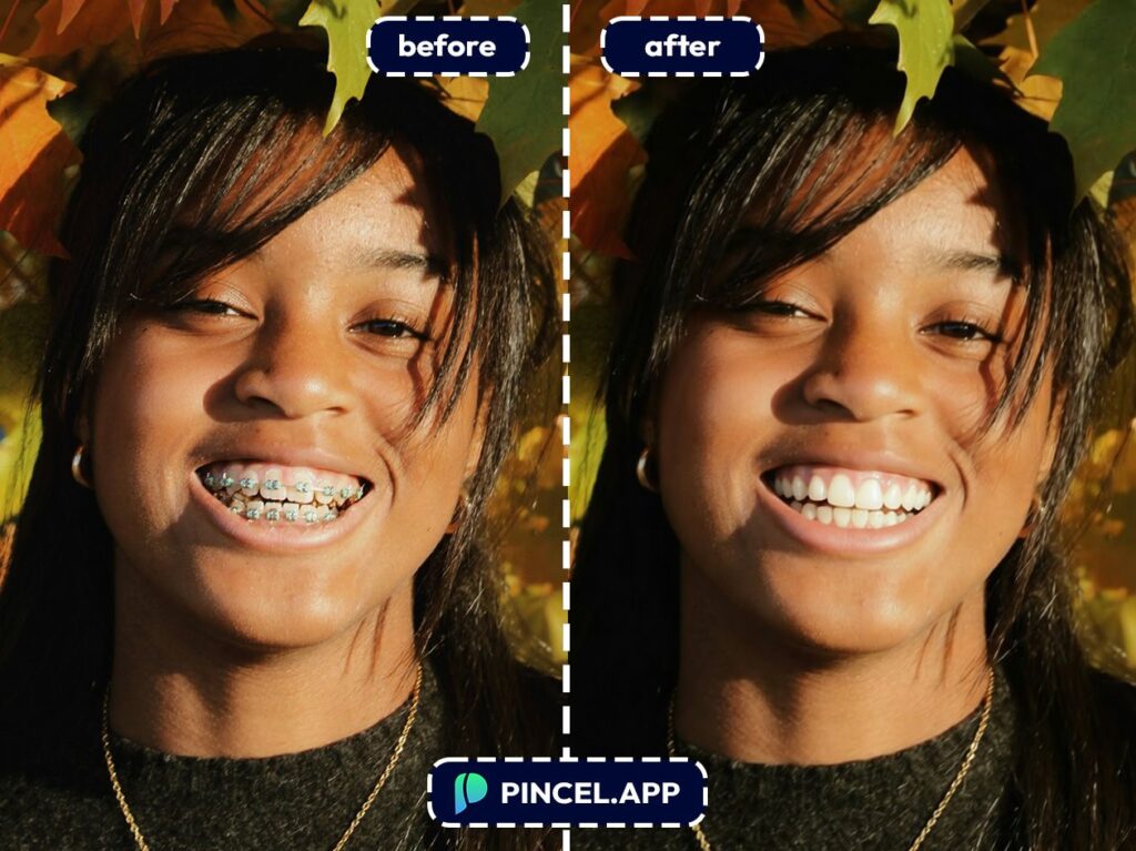 05_before-after-removing-dental-braces-with-pincel-AI-young-black-woman
