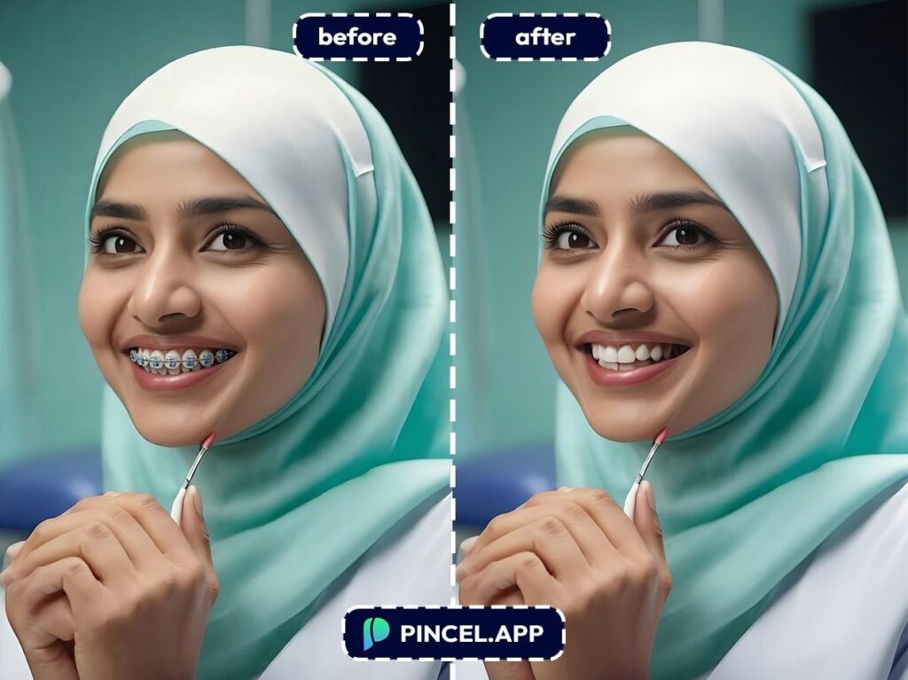06_before-after-removing-dental-braces-with-pincel-AI-woman-with-hijab
