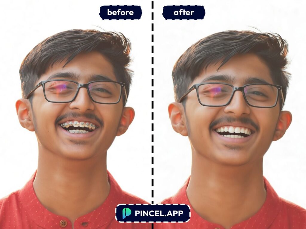 07_before-after-removing-dental-braces-with-pincel-AI-indian-kid
