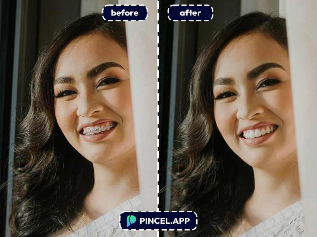 09_before-after-removing-dental-braces-with-pincel-AI-beautiful-woman
