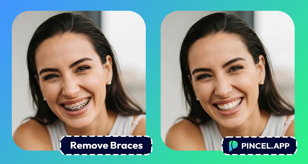 remove-braces-photo